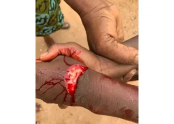 Man, 64, cuts boy, 9, hand with cutlass over sugarcane
