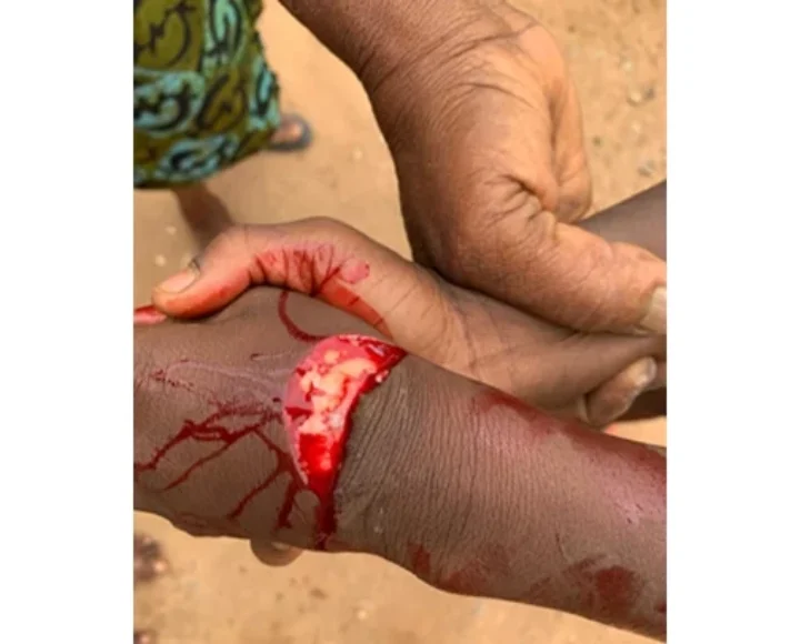 Man, 64, cuts boy, 9, hand with cutlass over sugarcane