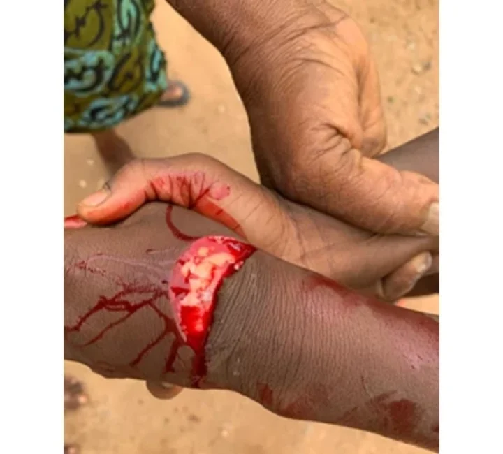Man, 64, cuts boy, 9, hand with cutlass over sugarcane