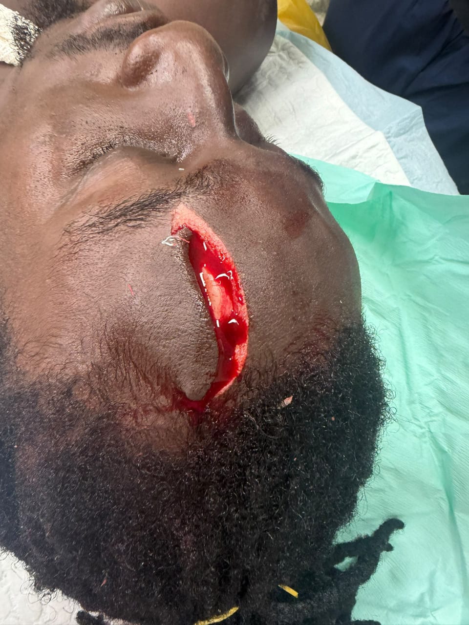 Jealous man attacks rival with sharp cutlass